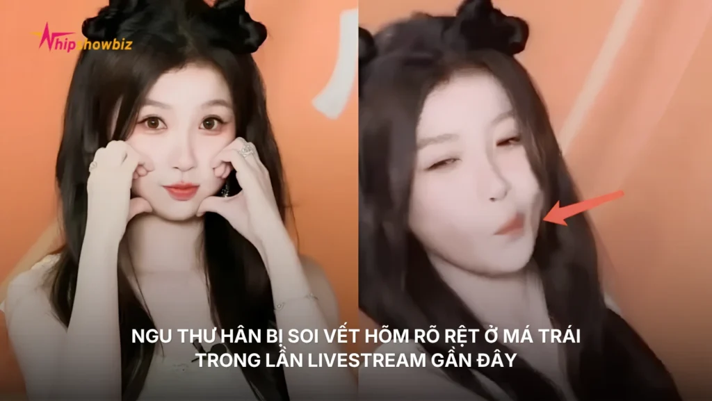 Ngu Thư Hân bị soi vết hõm rõ rệt ở má trái trong lần livestream gần đây